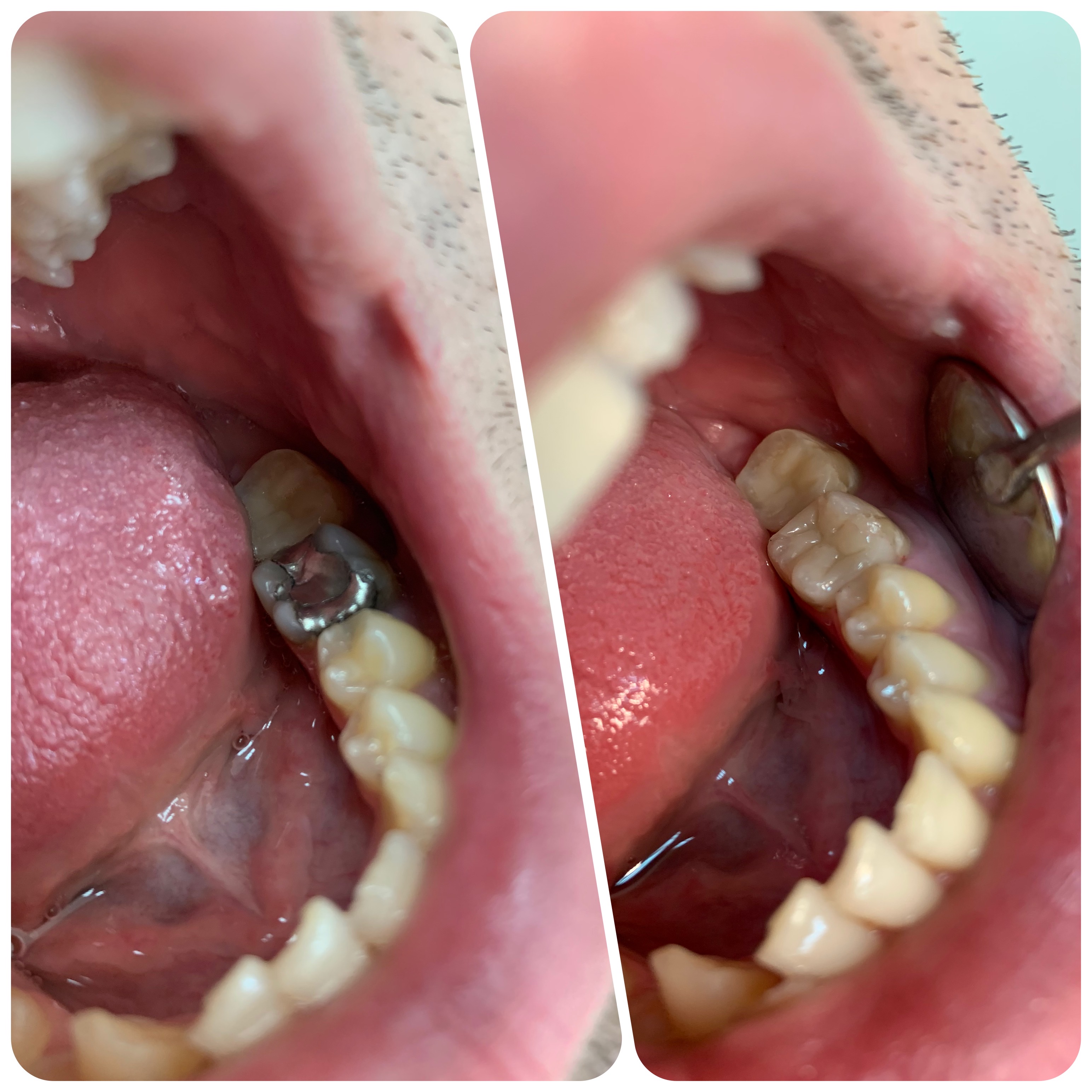 Dental work 1